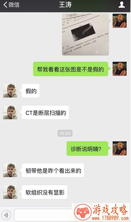 dota2pis骨折的CT